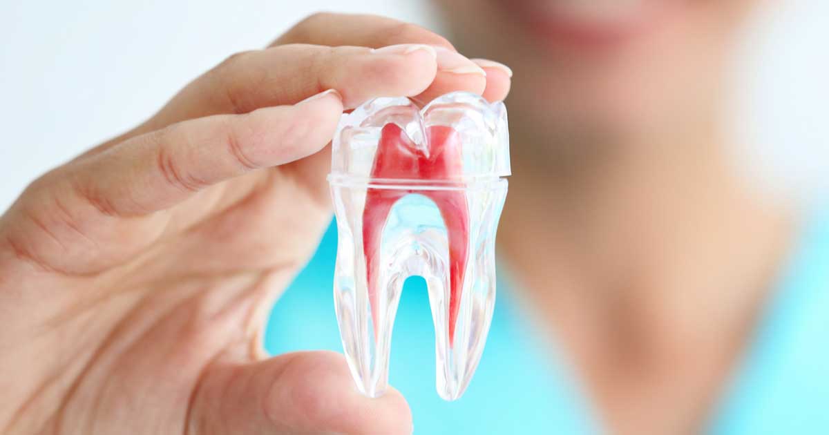 opd-root-canal Best Dental Implant Treatment In Siliguri